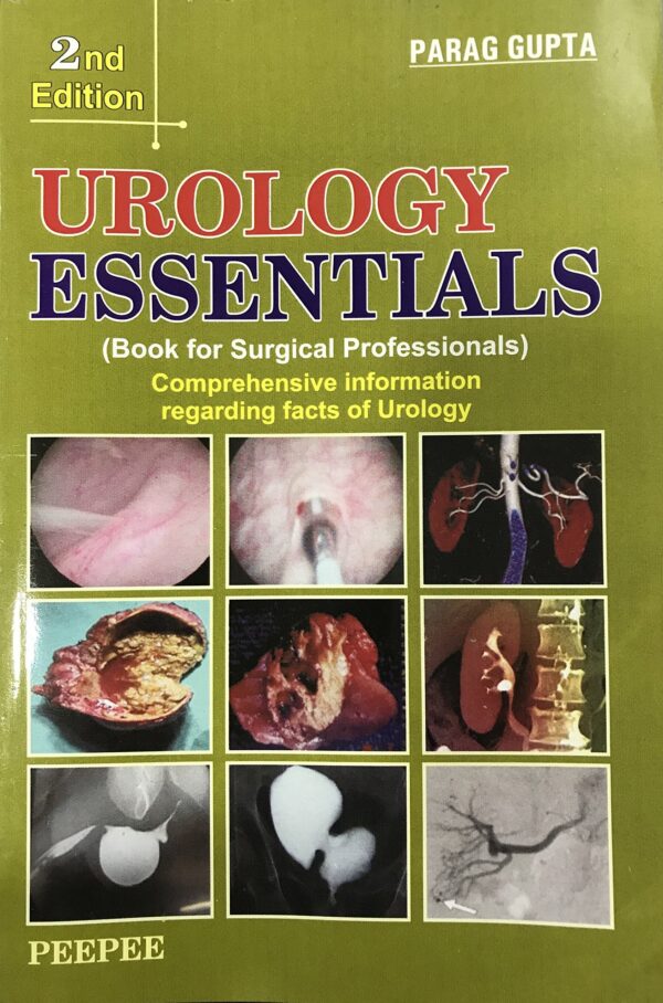 Urology Essentials